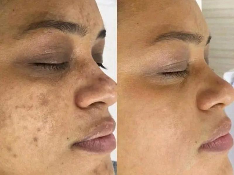 Consulta de Dermatologia