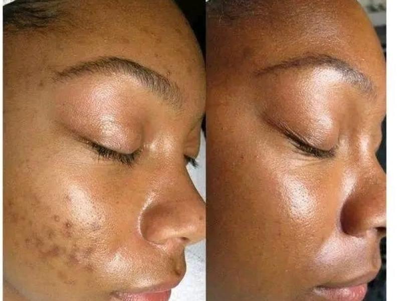 Estética